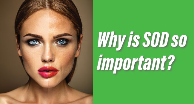 Why is SOD so important?